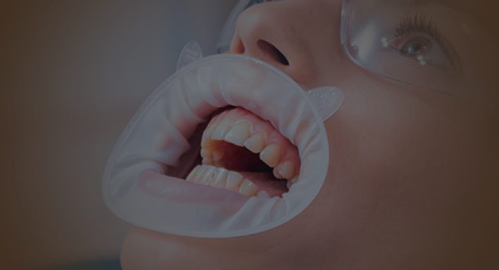 Endodontics Endodontics
