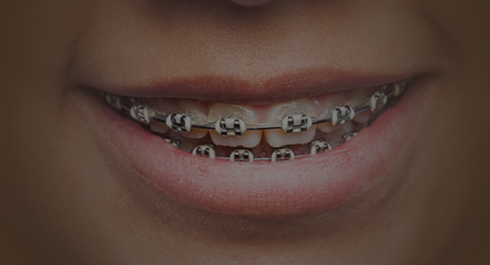 orthodontics orthodontics